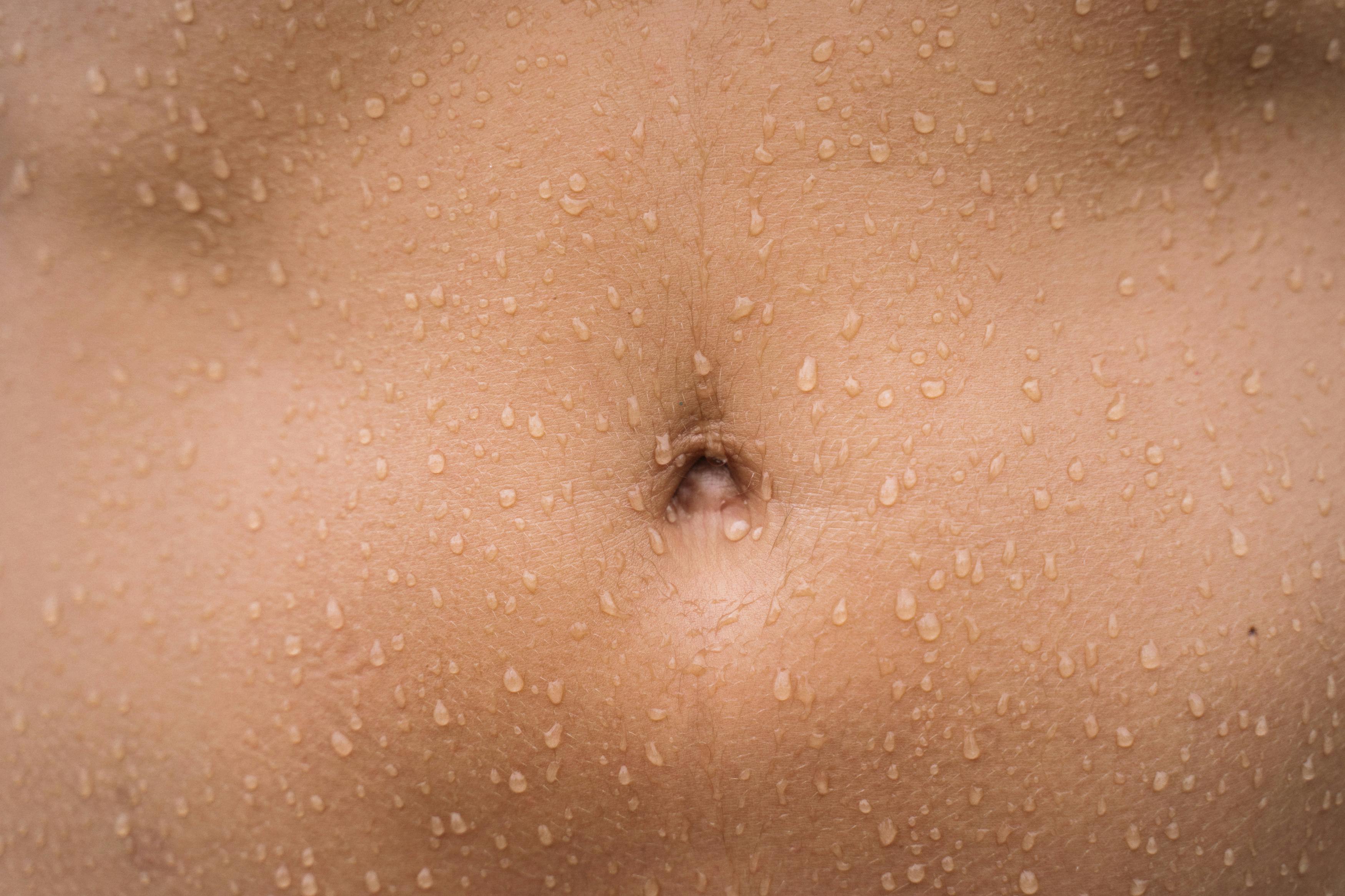PCOS and Body Odor-They ARE Related?