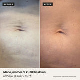 Before and after: Marie, mother of 2, after 120 days of daily TIGHT